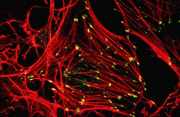 Stress fibres & focal adhesions