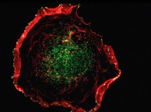 view Lamellipodia & membrane ruffles