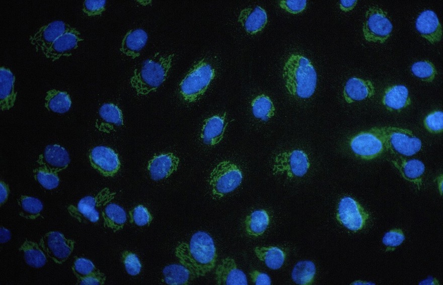 Golgi complex & cell nucleus