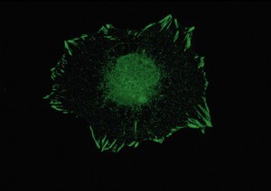 view Paxillin in focal adhesions