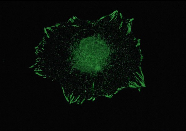 Paxillin in focal adhesions