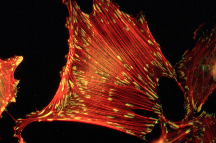 Stress fibres & focal adhesions