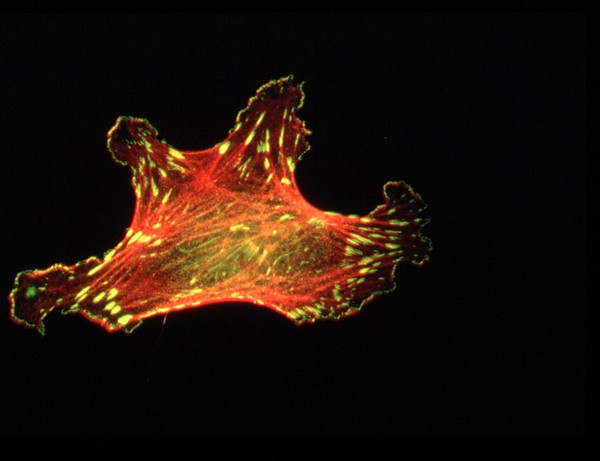 Stress fibres, focal adhesions & lamellae