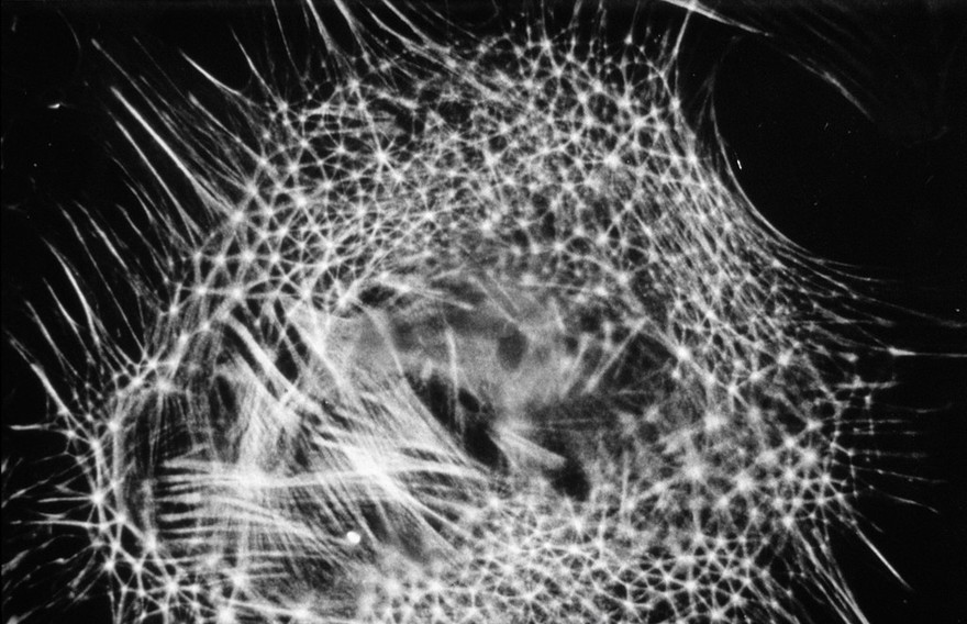 Actin fibres & geodesic domes