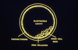 view Diagram of blastocyst