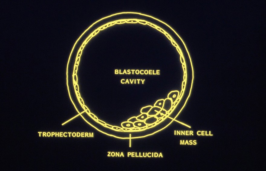 Diagram of blastocyst