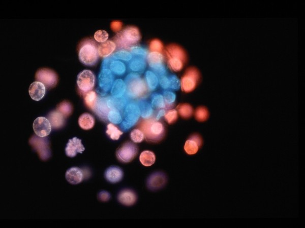 Mouse Blastocyst showing inner cell mass