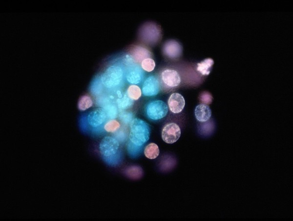 Mouse Blastocyst showing inner cell mass