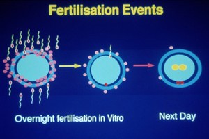 view Scheme for in vitro fertilisation