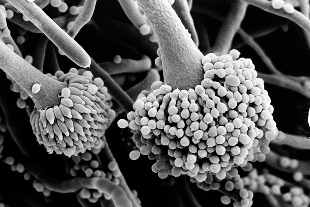 Aspergillus fumigatus, conidia & phialides