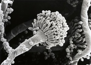 view Aspergillus fumigatus, conidium, SEM