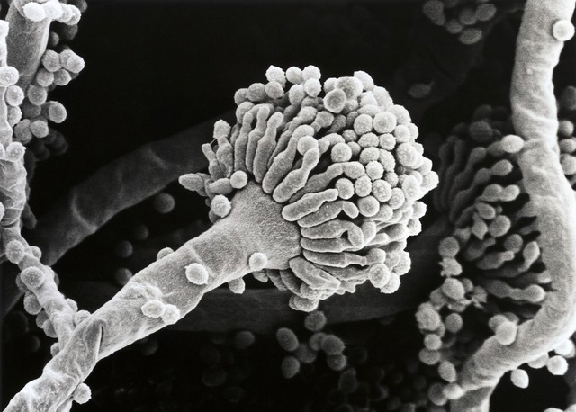 Aspergillus fumigatus, conidium, SEM