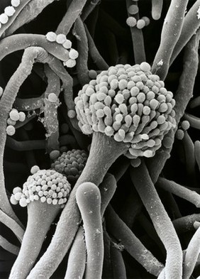 Aspergillus, 3 stages of conidiophore, SEM