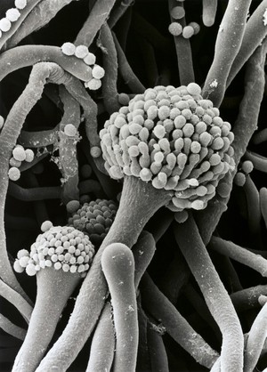 view Aspergillus, 3 stages of conidiophore, SEM