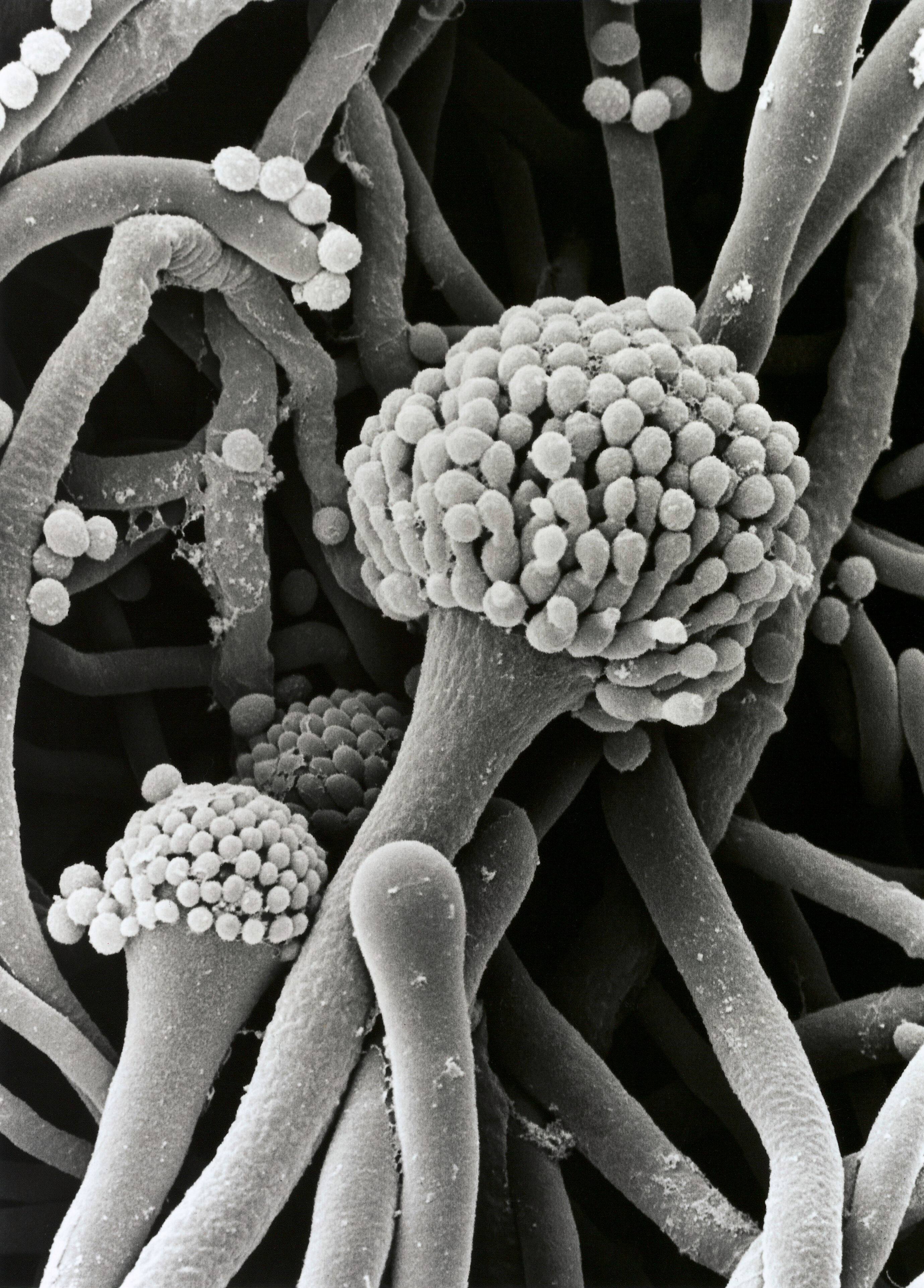 Aspergillus conidiophores