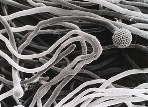 view Aspergillus, hyphae, 2 conidiophores, SEM