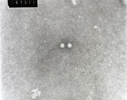 TEM of calici virus