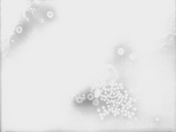TEM of Rotavirus and Astra