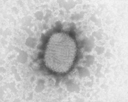 TEM of Molluscum virus