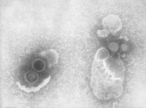 TEM of Herpes virus