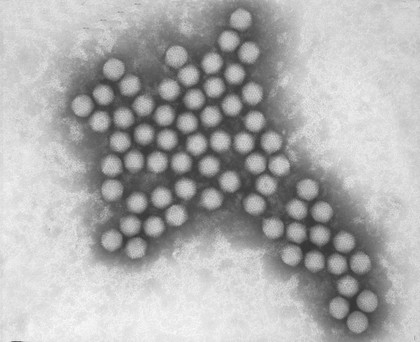 TEM of Adenovirus