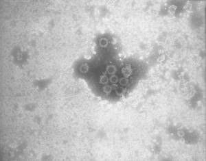 view Rotavirus, electron micrograph