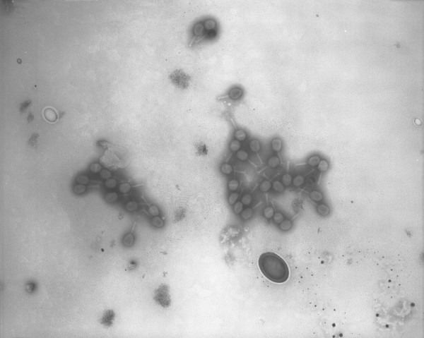 TEM of T phage