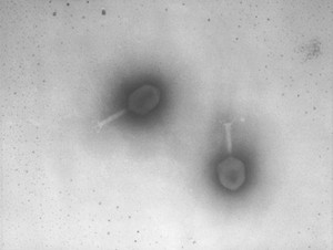 view TEm of T phages