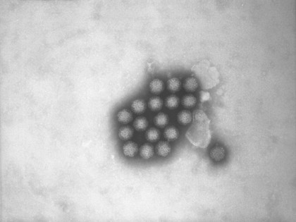 TEM of Reoviruses.