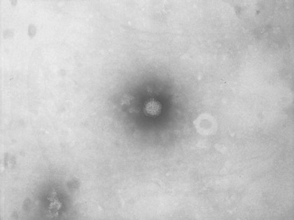 TEM of Reovirus