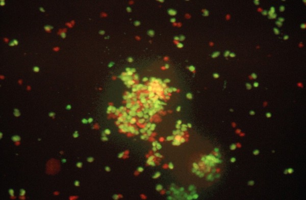 Neuronal precursor cell culture