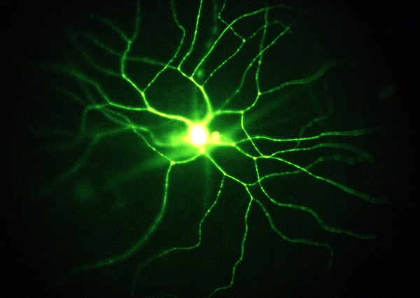 Type 1 ganglion cell in hamster retina