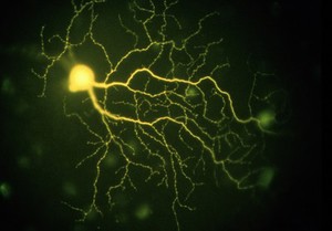 view "loose" gamma ganglion cell from the retina