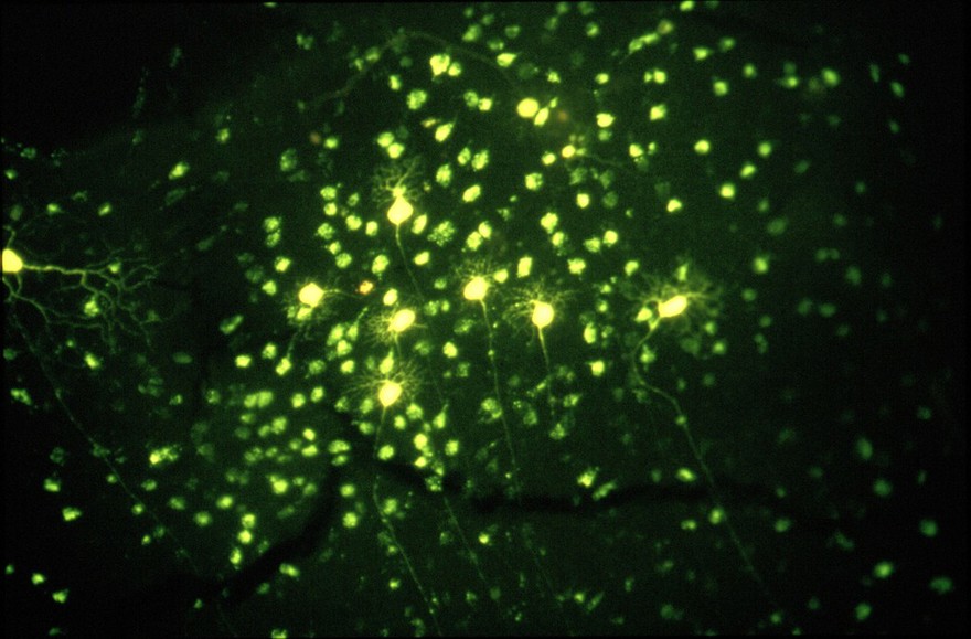 Beta ganglion cells in the retina