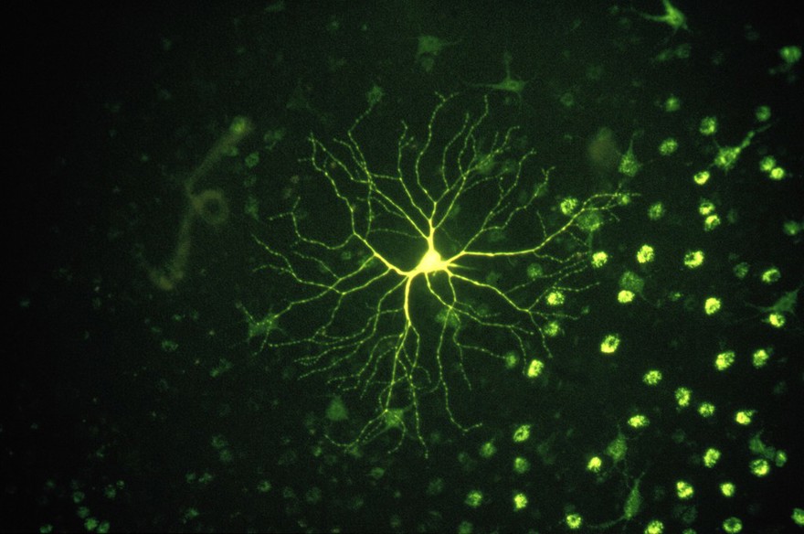Alpha cell in the ferret retina