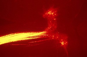 view Occulomotor nerve and occulomotor nucleus