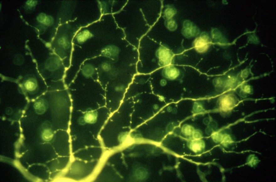 Alpha cell in the ferret retina