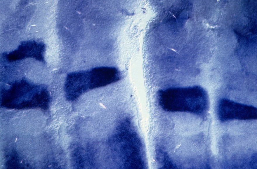 in situ hybridisation to avian hindbrain