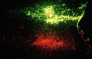 view Fluorescent microspheres in the cortex