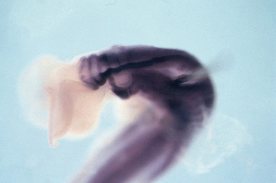 Hoxa-2 in situ hybridisation in chick embryo