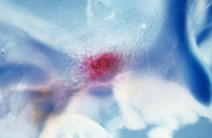 view Membrane bone ossification