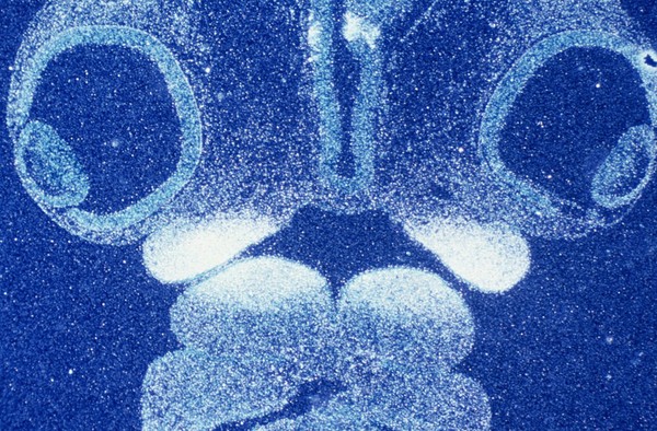 The Lhx-7 gene in the oral mesenchyme