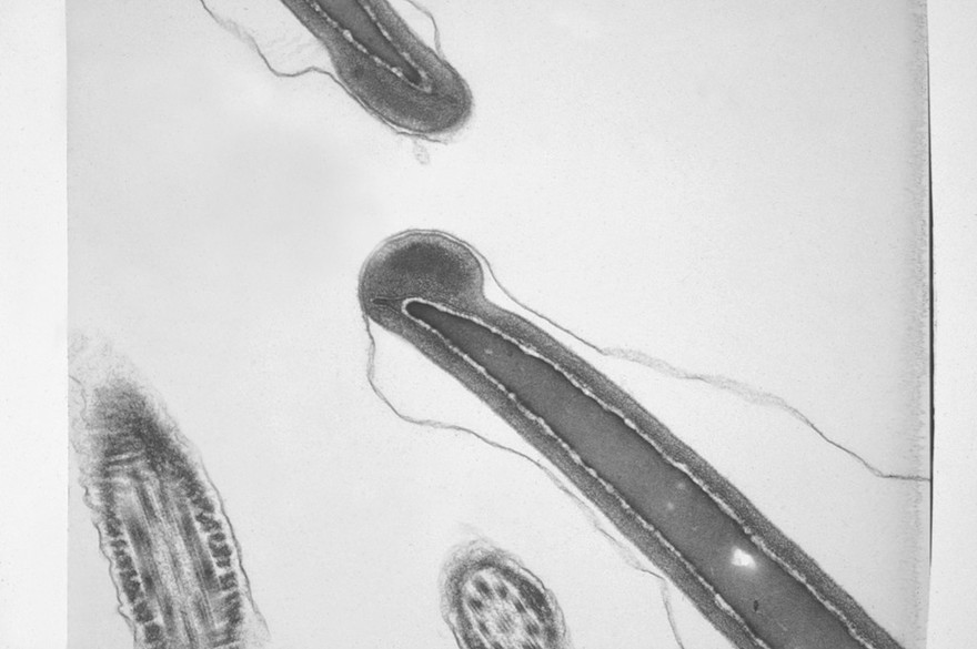 Normal bovine sperm