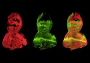 view Confocal image of an eye-antennal disc from a