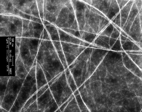 TypeXI collagen fibrils forming in vitro