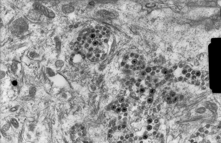 Herpes simplex viruses in epithelial cell