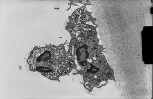 view Polymorphonuclear leucocytes - TEM