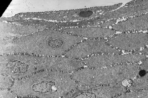 view Corneal epithelium with desquamating cell