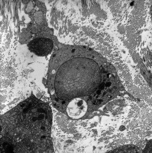 view Stromal granulocyte with large lamellar body