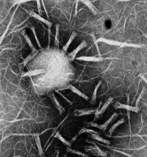 view Type II collagen assemblies in vitro